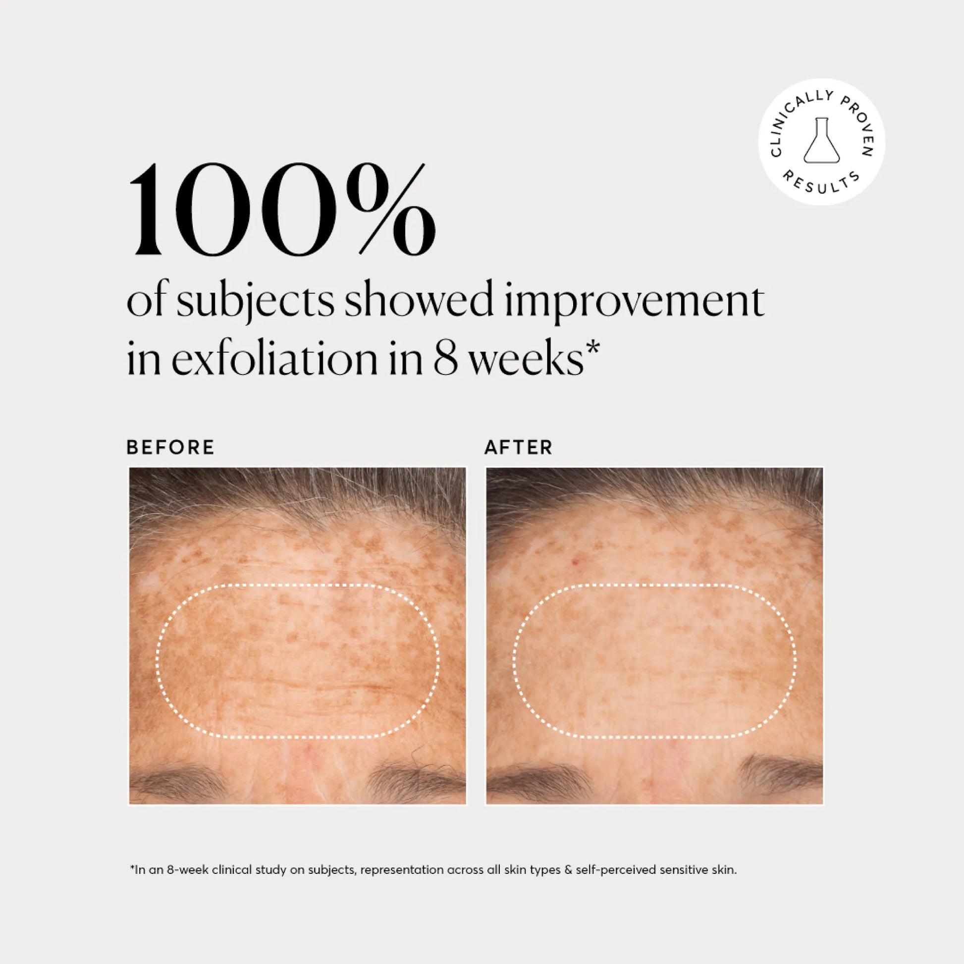 bha-liquid-exfoliant-2-o8 NATR-10027-Alt-Images-BHA-Liquid-Exfoliant-2_-03.webp