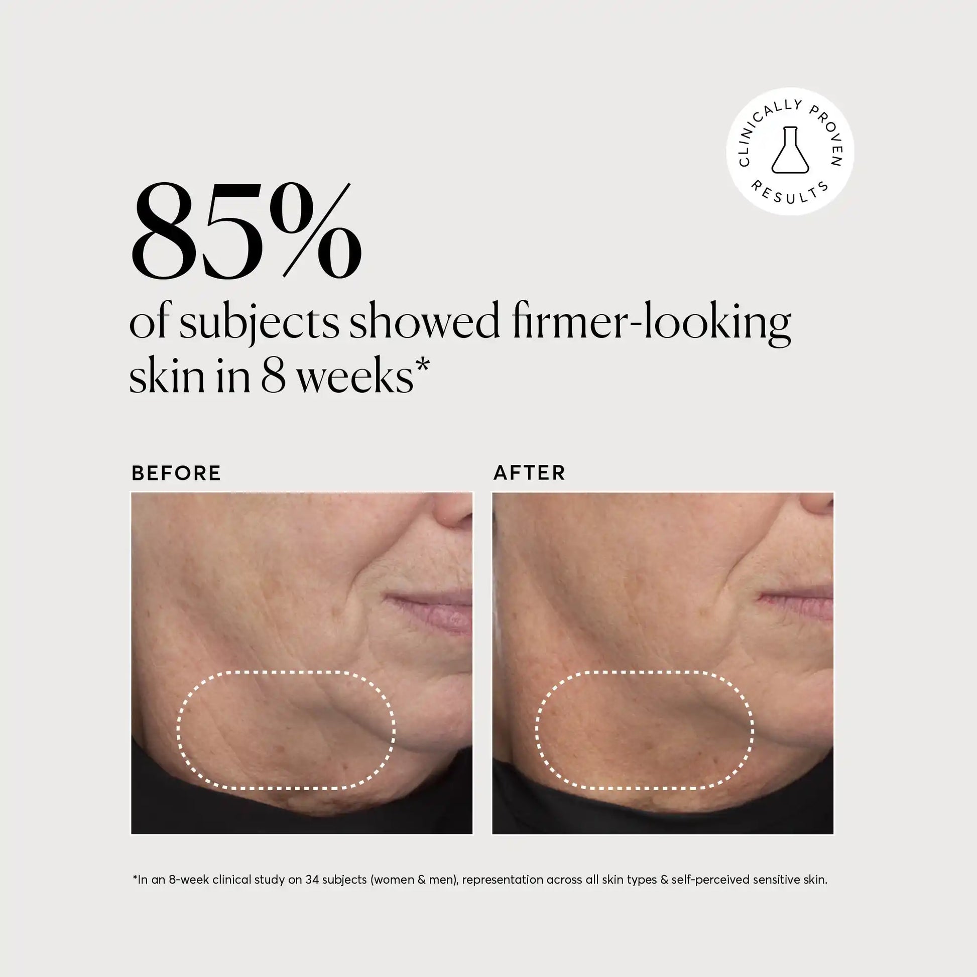 retinol-complex-serum-q3 NATR-10034-Alt-Images-Retinol-Complex-Serum-04.webp